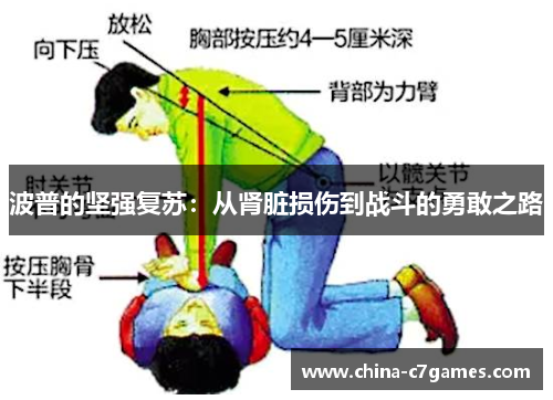 波普的坚强复苏：从肾脏损伤到战斗的勇敢之路